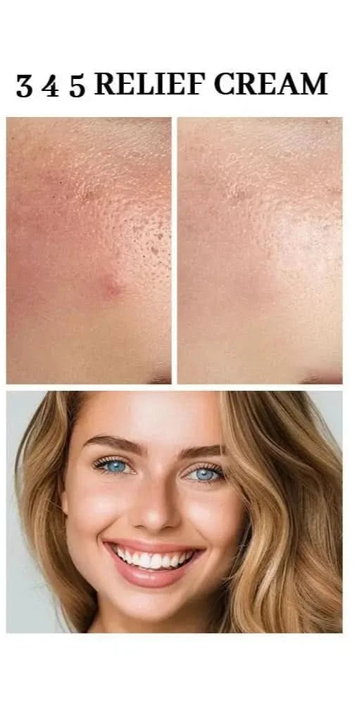 345 crème de soulagement crème hydratante pour le visage nourrir apaisant réparation de la peau acné propre pour peau grasse, Lotion hydratante pour le visage soins de la peau Jay Cosmetic