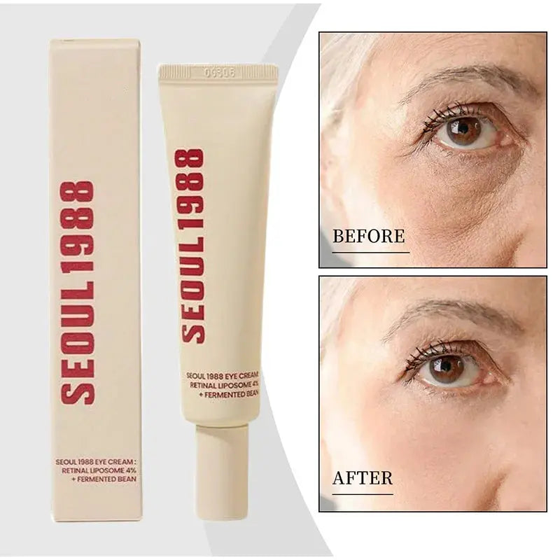 Séoul 1988 crème pour les yeux au rétinol 4% traitement Anti-âge pour les yeux cernes, rides, poches crème pour les yeux raffermissante et liftante pour les femmes Jay Cosmetic